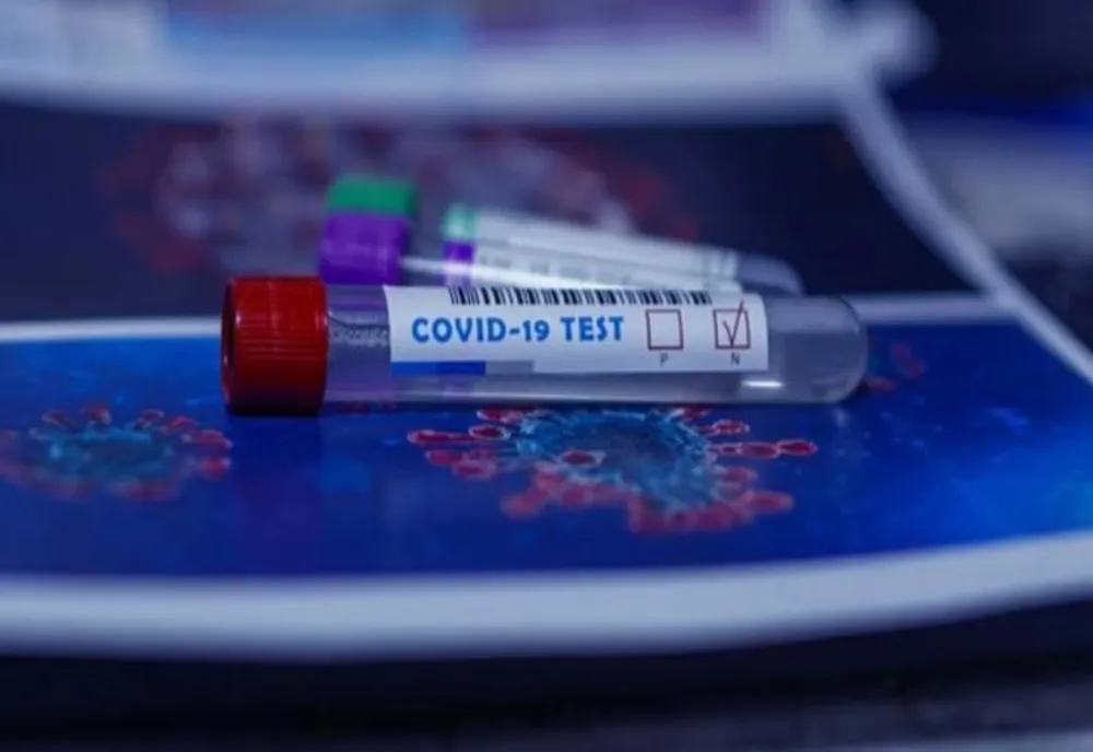 Bilanț coronavirus 21 august: 1.392 de cazuri noi, 42 de decese și 497 de persoane internate la ATI