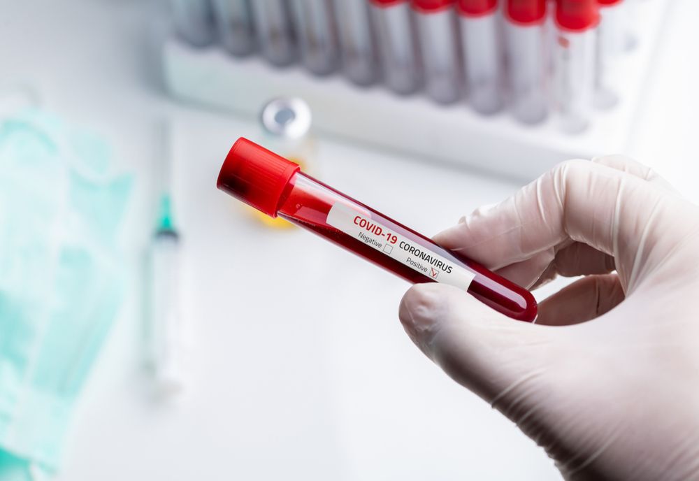 Încă patru cazuri confirmate de coronavirus în județul Suceava