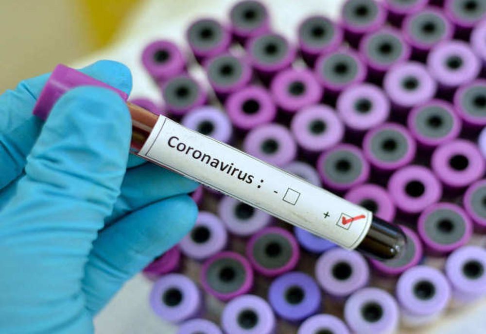Un angajat de la Centrul de Recuperare și Reabilitare Neuropsihiatrică Costâna diagnosticat cu coronavirus