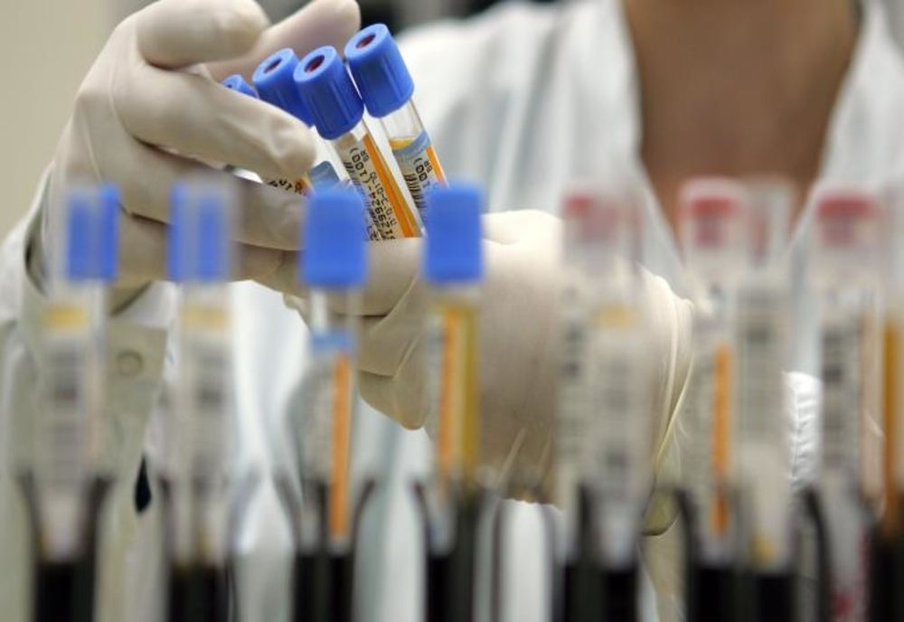 Noi decese cauzate de infectie cu COVID-19, anunțate duminică seara. Numărul a ajuns la 314