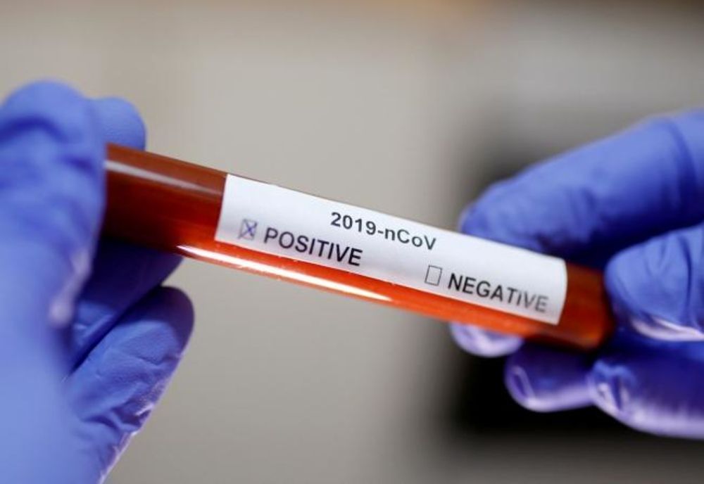 Bilanț coronavirus 12 martie: 5.010 cazuri noi și 108 decese