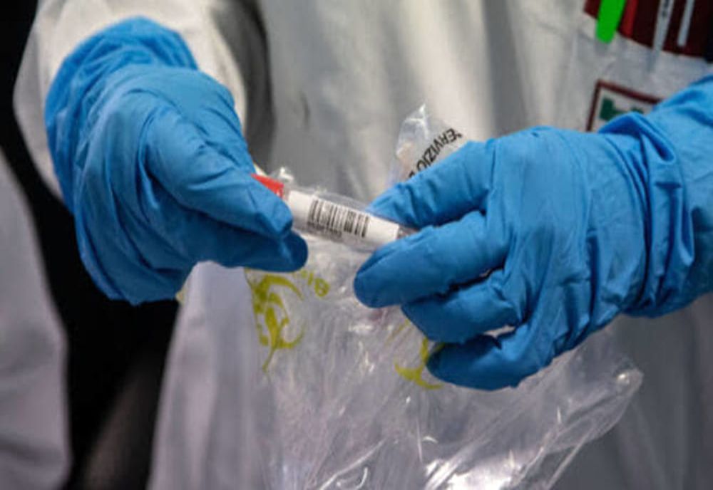 181 de cadre medicale și personal auxiliar confirmate cu coronavirus în județul Suceava