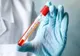 Cinci persoane cu suspiciune de coronavirus, internate la Spitalul Județean Suceava