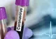 Primul caz de coronavirus în Ucraina. Bărbatul s-a întors din Italia prin Aeroportul Suceava