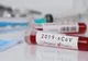 27 de cadre medicale de la Spitalul Județean Suceava depistate pozitiv cu coronavirus