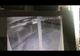 VIDEO Accidentul rutier grav de la Vicovu de Jos, suprins de o cameră de supraveghere