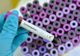 Un român din Italia infectat cu coronavirus A MURIT
