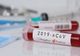 A fost înregistrat cel de-al treilea deces din cauza CoVid-19, în România! Teoretic, bărbatul nu a intrat în contact cu vreo persoană infectată și nici nu a călătorit