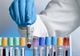 Al șaselea caz de coronavirus confirmat în România. Este vorba despre un sucevean de 71 de ani