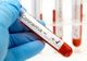 România atinge un nou record de noi cazuri de infectări cu coronavirus
