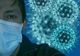 Coronavirus 16 noiembrie: 4.931 cazuri noi şi 149 deces. Ce se întâmplă în fiecare judeţ