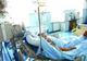 Un caz de botulism diagnosticat la Spitalul Judetean Suceava